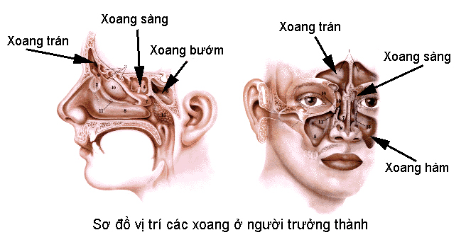 Viêm xoang trên hình ảnh X-quang - PGS Hà Hoàng Kiệm