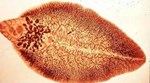 Bệnh sán lá gan (Clonorchiasis)