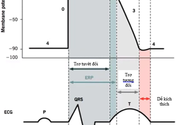 Cơ chế rối loạn nhịp (giải thích ngắn gon)