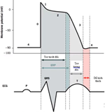 Cơ chế rối loạn nhịp tim (giải thích ngắn gon)